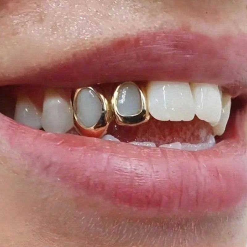 -Golden Grillz Tooth Jewelry S - Body Jewelry Changing Kit ulasan dan harga